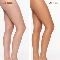 Before and after: legs with ordinary redness and uneven tone evened and covered with NUELLE Body Perfector
